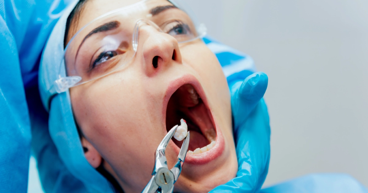 Dentist performing gentle, painless tooth extraction with care